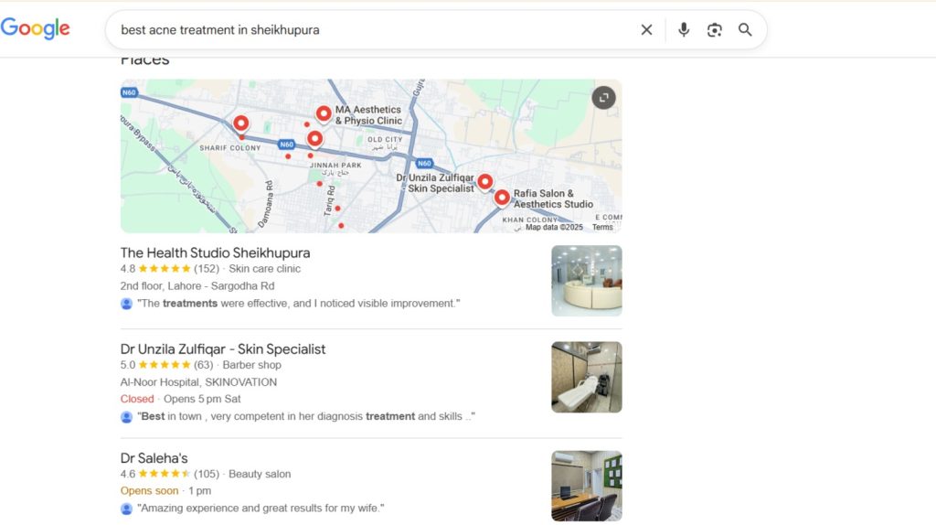 Best Acne Treatment in sheikhupura