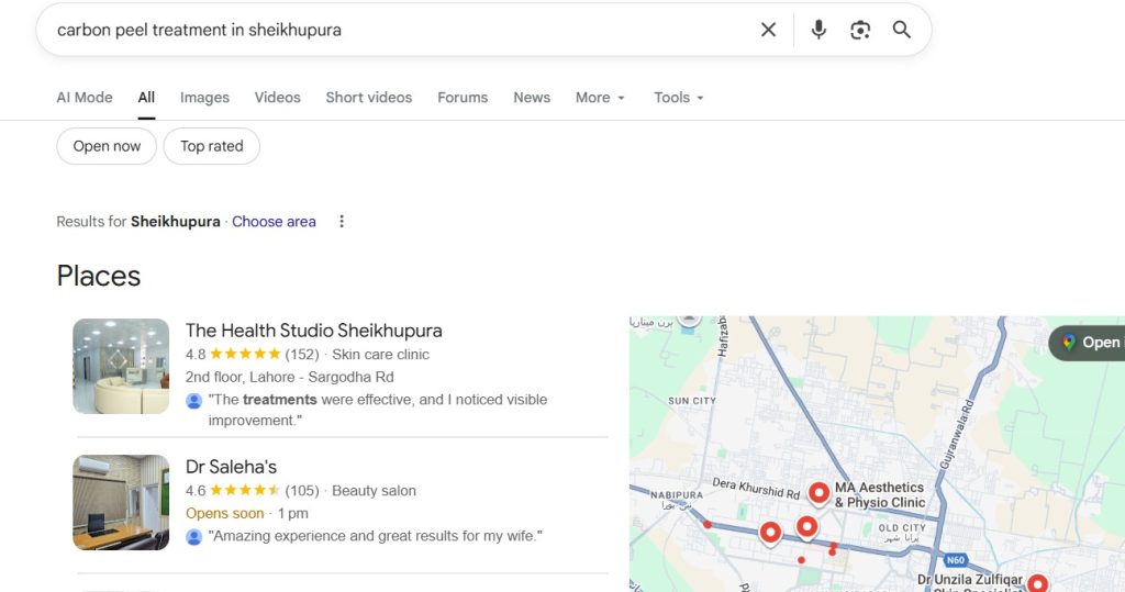 Carbon peel treatment in sheikhupura