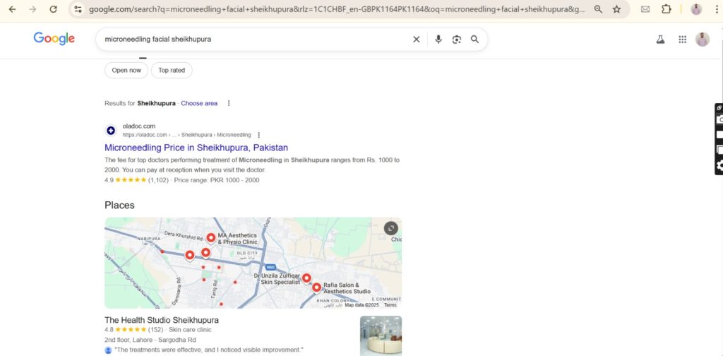 Microneedling facial Sheikhupura