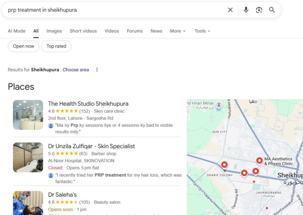 PRP hair treatment in sheikhupura