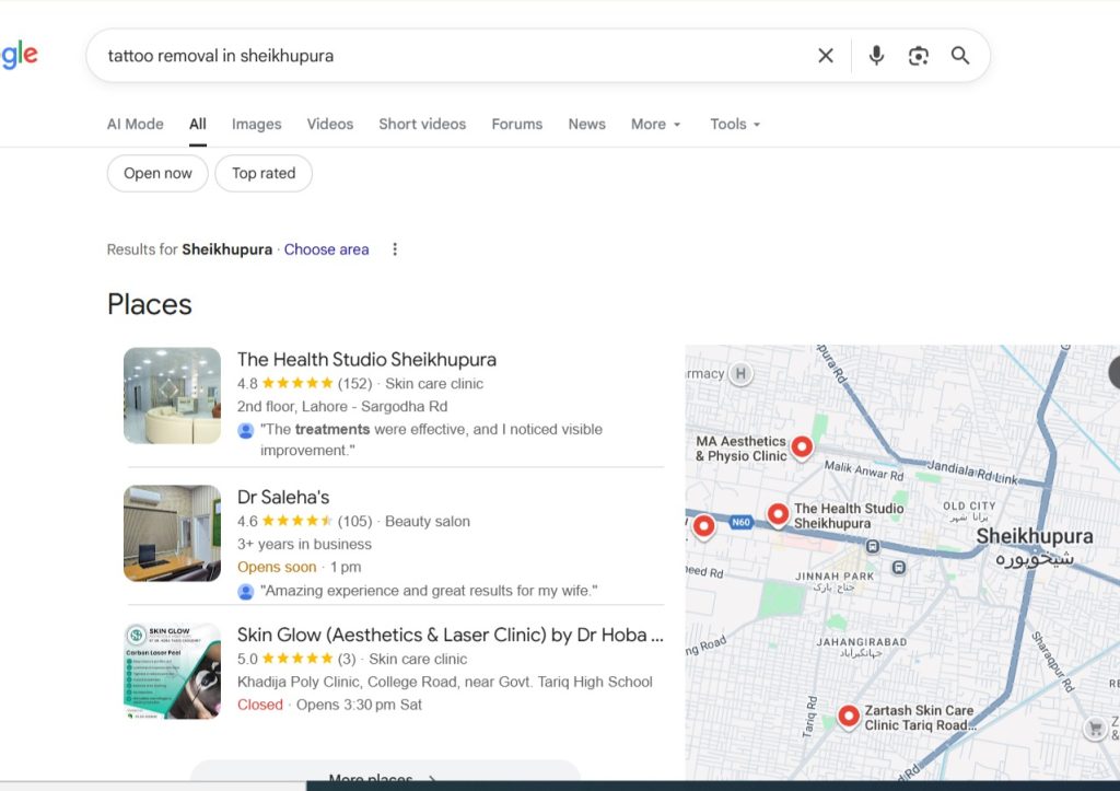 Tattoo removal in sheikhupura